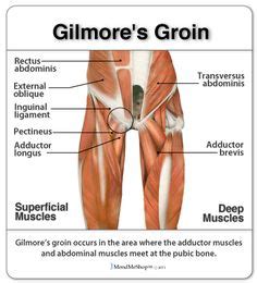 The muscles in the medial compartment of the thigh are collectively known as the hip adductors. 10 Best Groin Strain & Injury images | Health fitness ...