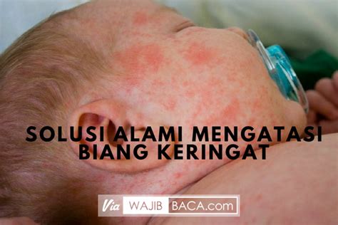 Berikut keadaan umum yang dapat menyebabkan munculnya bintik merah pada kulit bayi. Buah Hati Rewel Karena Biang Keringat! Jangan Panik, 7 ...