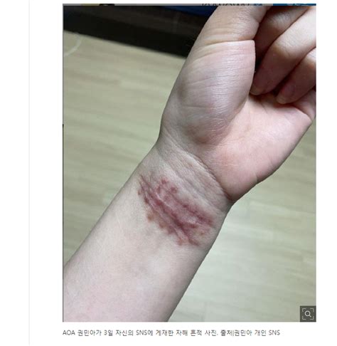 하지만 어떤 악플러가 '뒤질거면 한번에 제대로 그어가지고 죽었으면 좋겠다'고 하더라. 권민아 상처 / ê¶Œë¯¼ì•„ ì§€ë¯¼ ê´´ë¡­íž⃜ ì¦ ê± ...