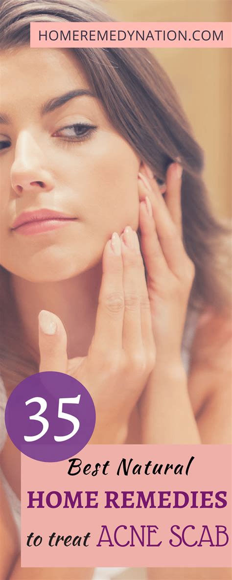 One of the best treatments for sunburns is aloe vera, especially for the first few days. 35 Efficacious Home Remedies to Get Rid of Acne Scabs ...