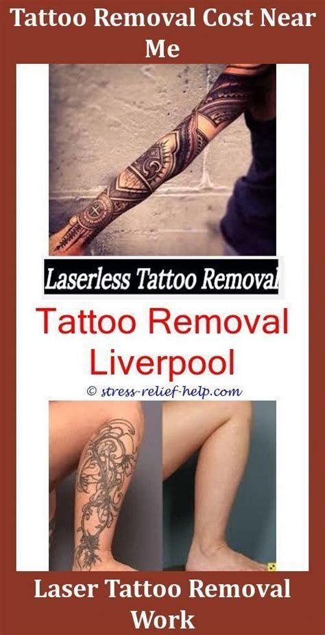 As a result, superficial blisters containing water and ink may appear. Is Laser Tattoo Removal Safe Tattoo Removal Blisters ...