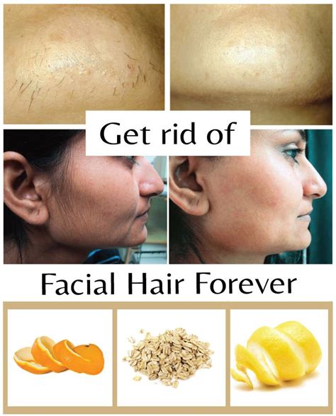 Facial hair is a category of cosmetic collectibles worn on a character's face. Get rid of facial hair forever - Wiki Remedies | Lip hair ...