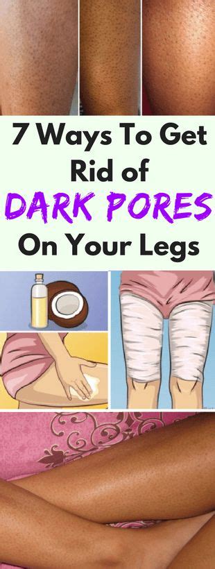How to get rid of strawberry legs in one day! 7 WAYS TO GET RID OF DARK PORES ON YOUR LEGS - Health ...