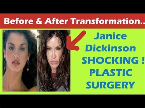 Download other design about janice dickinson before after plastic in our latest gallery. Janice Dickinson Plastic Surgery Before and After Full HD ...