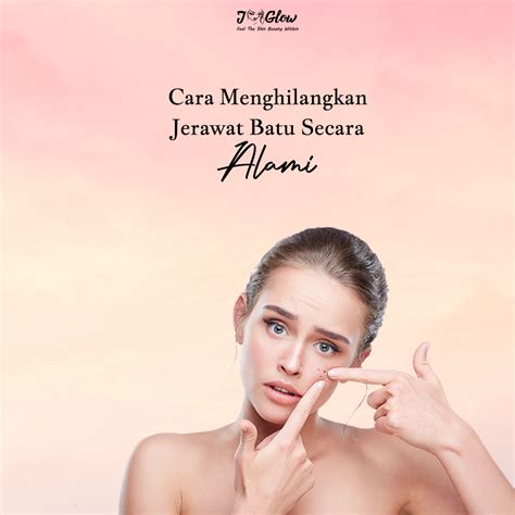 Artis cantik hollywood menikah dengan kulit hitam. Cara Menghilangkan Jerawat Batu Secara Alami - JGlow Official