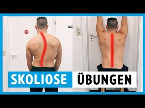 Inhalte, voraussetzungen, gehalt, hochschulen, praxispartner und freie studienplätze! Skoliose Übungen vom Physiotherapeuten (für zu Hause ...