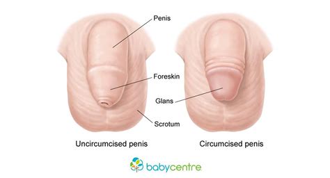 Do you have any images for this title? Circumcision in baby boys - BabyCentre UK