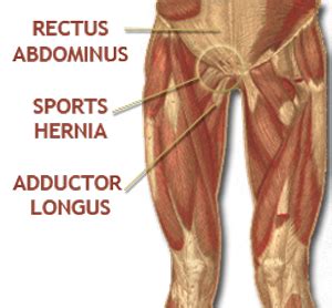 We hope you will use this picture in the study and. Sports Hernia Anatomy