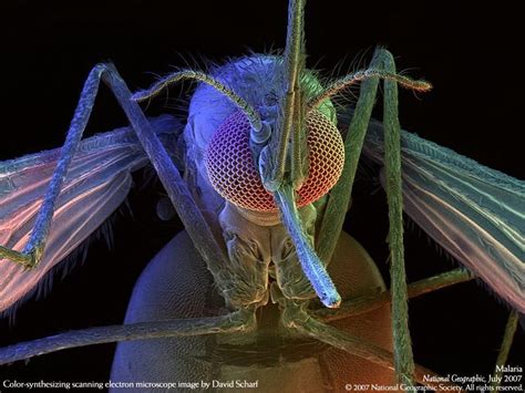 Clinicians examine erythrocytes under light microscope to study the color and morphological changes toward malaria diagnosis. Pin on AP Art Ideas