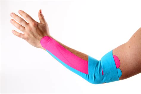 Der tennisarm, von handchirurgen auch tennisellenbogen genannt, oder medizinisch epicondylitis lateralis humeri, ist eine. Globuli bei Tennisarm | Infos, Einnahme & Dosierung