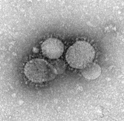 Many mers patients reported having no contact with animals before becoming sick. Trip Wire: Q&A with Epidemiologist Stephen Morse ...