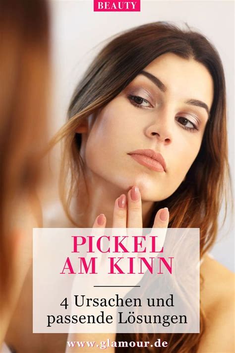 Tipps gegen pickelmale und pickelrötungen. Pickel am Kinn : Pickel am Kinn: 4 Ursachen plus passende ...