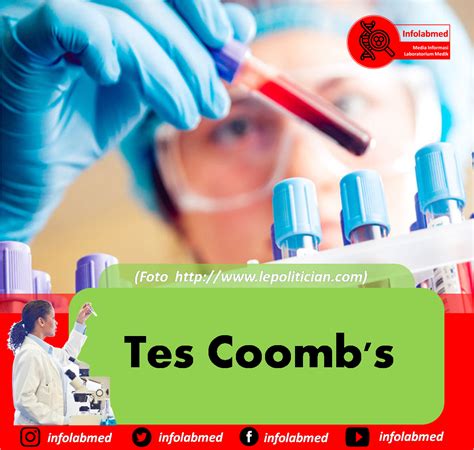 We did not find results for: Tes Coomb's Persiapan Pasien, Prinsip, Alat dan Bahan, Cara Kerja, Interpretasi Hasil | Info ...