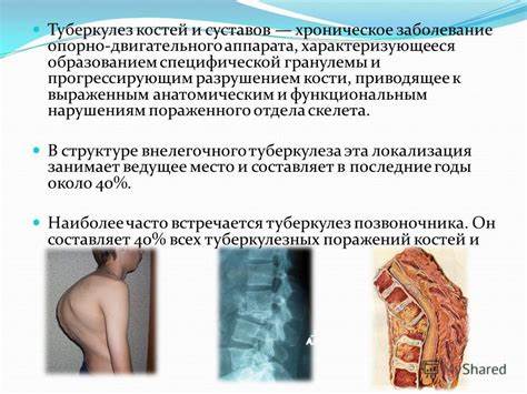 Туберкулез у детей диета