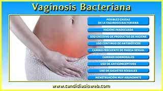Síntomas de la candidiasis - Prurito Anal y Vaginal