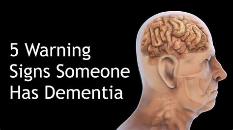 5 Warning Signs Someone Has Dementia | Dementia, Diabetes education ...
