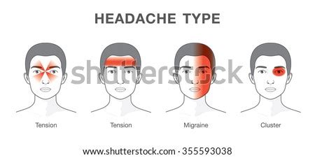 Back corners can be good entrance points (think servant delivering message) and can have the effect of adding depth, especially if the other actors are towards the front on the other side. Illustration About Headaches 4 Type On Stock Vector 355593038 - Shutterstock