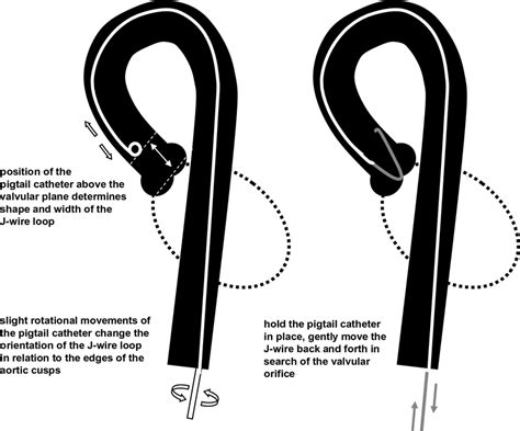 The diagrams below show the typical trailer wiring for 4 pin flat connectors all the way to 7 pin round connectors. Pigtail Wire Diagram / Q A To Pigtail Or Not To Pigtail Jlc Online / Dryer cord and wiring dryer ...