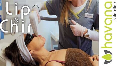 No more waxing, plucking, threading, or shaving with the livsmooth guarantee. Laser Hair Removal | Lip & Chin - YouTube