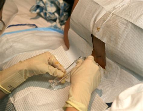 Lumbar puncture LP position procedure | ALiEM