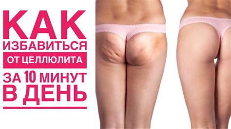 КАК УБРАТЬ ЦЕЛЛЮЛИТ за 10 МИНУТ - YouTube