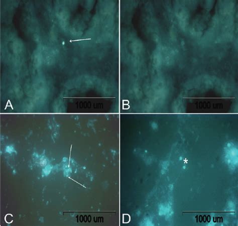 Survival of cryptosporidium parvum oocysts under various environmental pressures. Cryptosporidium sp. oocyst at the epifluorescente ...