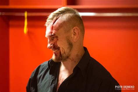 More images for świątek tymoteusz » Rozcięcie na pół czoła! Zobacz jak wyglądał Tymek Świątek ...