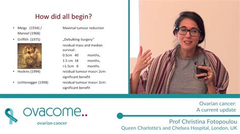 Ovarian cancer affects the ovaries, which are a keypart of the female reproductive system. Ovarian cancer: a current update - YouTube