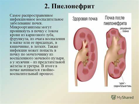 Воспаления в кишечнике диета