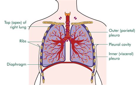 We did not find results for: Mesothelioma Lung X ray Histology CXR CT Cancer Ribbon ...