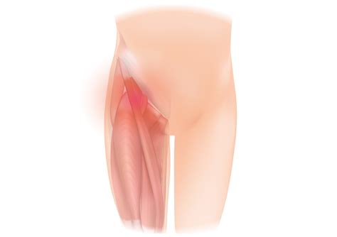 They are important for stabilising the body and for it works better during single movements. File:Hip-groin pain.jpg - Wikimedia Commons