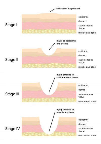 Wound care is arguably the single most difficult topic in medicine. Wound Care Manual and Clinical Guidelines for Nurses ...