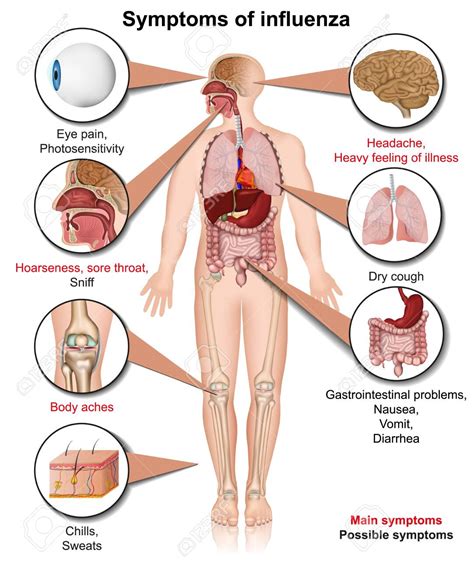 Flu can affect anyone but is especially serious for babies and older people. The Most Common Influenza Symptoms | Symptoms of Virus