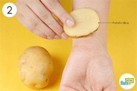 Razor burn is a type of skin irritation that not only looks unsightly but can also be a source of pain and discomfort. apply potato slice to treat minor burn | Healing, Burns ...