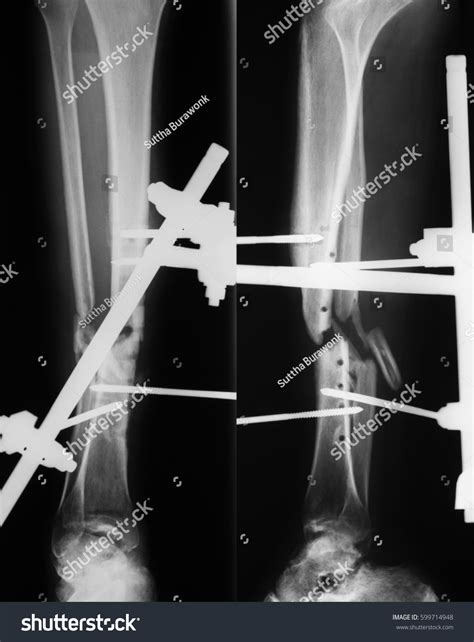 Maybe you would like to learn more about one of these? Edit Photos Free Online - X-ray image | Shutterstock Editor
