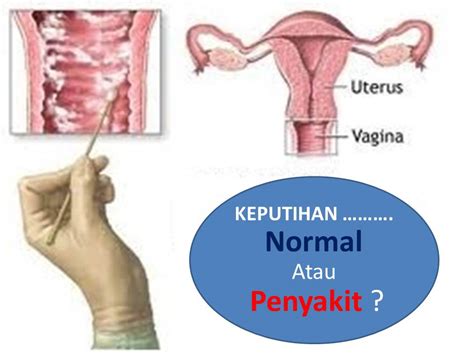 We did not find results for: Ciri Ciri Keputihan Yang Tidak Normal - Agen Ladyfem Boyke