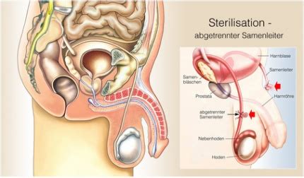 Sie unterscheidet sich dadurch von der schraube, die sich mit konstantem abstand. Samenleiter - Funktion, Aufbau & Beschwerden | Gesundpedia.de