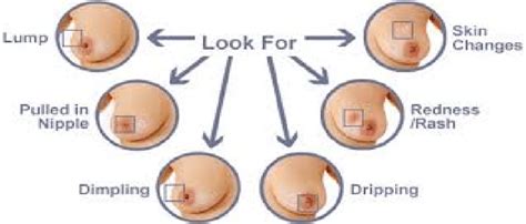 Though the statistics might be scary, catching breast cancer early can make a real difference in the success of treatment. Signs of Breast Cancer | Download Scientific Diagram