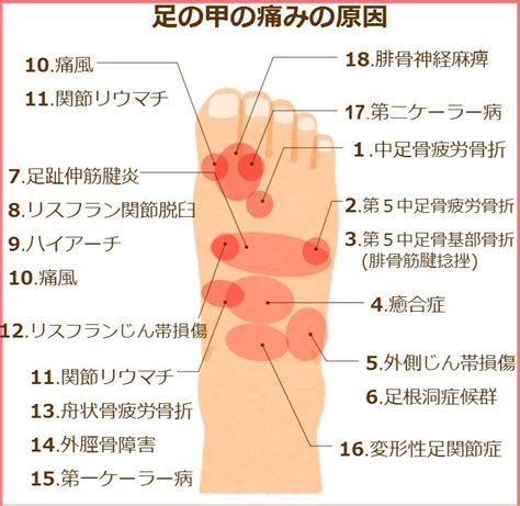 きくおミク3 (kikuo miku 3) (album). 足の甲が痛い!痛む場所ごとに図で見る18の原因 | | 足の甲, 足 ...