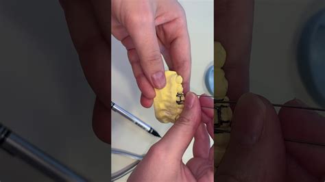 Introduced by c philips adams. Adam Clasp demonstration | By Dr. Saya Mustafa # ...