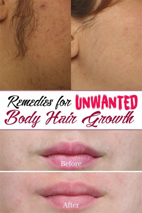 But like with funk, you can't spray on more cologne to cover it up, thinking it'll go away. Remedies for unwanted body hair growth | Body hair growth ...