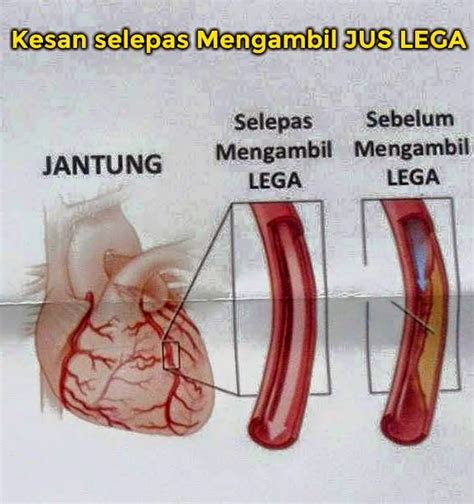 ✔ menurunkan kadar kolesterol dalam darah. JUS LEGA PACKING BARU 2019 : PENAWAR PENYAKIT DARAH TINGGI ...