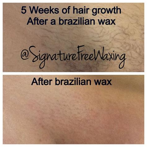 If you are wondering how long you should go between brazilian waxes, it depends on the factors mentioned above. Top photos: 5 weeks of hair growth after receiving a ...