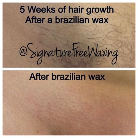 So, you can start to see hair growth that is very minimal in the first week after your wax. Top photos: 5 weeks of hair growth after receiving a ...