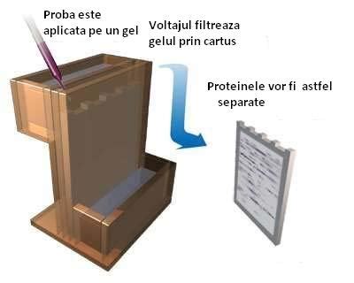 Orice litiază poate fi tratată la ovidius clinical hospital, fiind singurul spital privat din dobrogea care oferă posibilitatea pacienților de a trata litiaza urinară prin ureterorenoscopia flexibilă cu laser, ureterorenoscopie semirigidă, nlp. Poze medicale Scleroza multipla