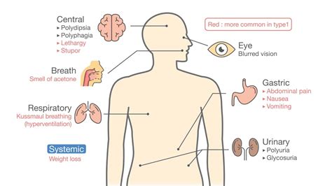 Oct 27, 2019 · the patient might present with any of the symptoms like visual defects, dermatitis, increased thirst and/or hunger, increased micturition, weight loss etc which may be because of underlying diabetes. How to Reverse Diabetes Symptoms Naturally (Without Medicine)