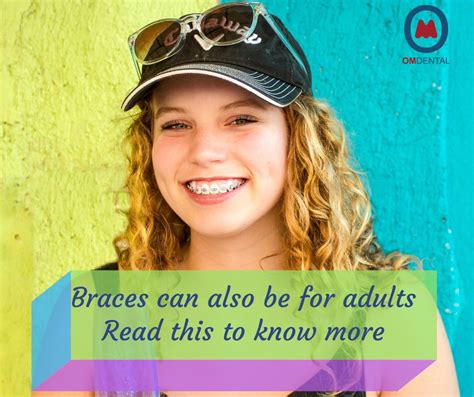When you attach metal brackets to the teeth, there's almost no way that it won't most patients will need to wear their braces for between 18 to 30 months. All you need to know about braces for adults