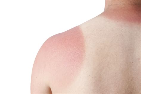 It was founded in september 2001 to directly lobby the goals of the american cancer society. Soak Up the Rays without Soaking Them In: Be Sun Safe and ...
