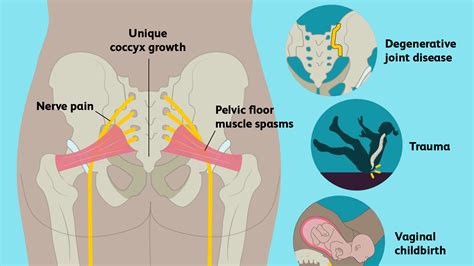 Backbone views don't contain html for our application, but the logic behind the presentation of the models. Diagram Of Common Back Bone Break / Broken Bone Pictures ...