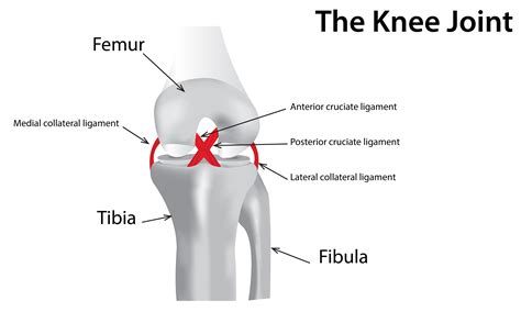 The forces pushes the tibia backward to an extent. Knee Injuries | KneePain.com